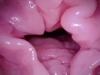 Watch Muff Coaster's Labia get a camera in POV - A hymen fetish video!